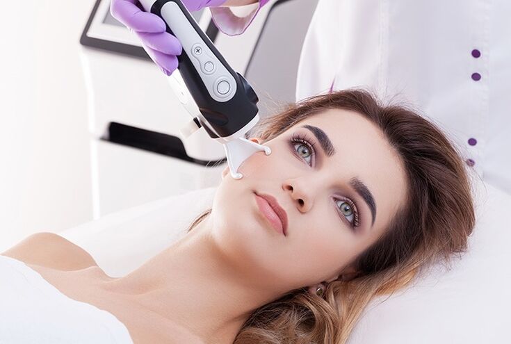 Laser rejuvenation