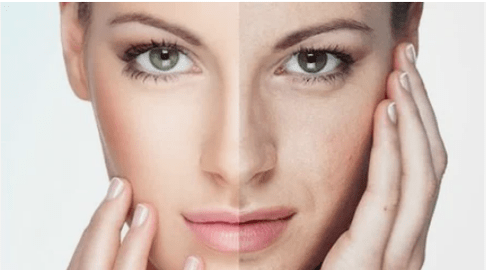 Effective rejuvenation of the face